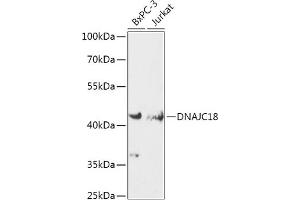 Western blot analysis of extracts of various cell lines, using DN antibody (ABIN7266825) at 1:1000 dilution. (DNAJC18 anticorps  (AA 260-350))