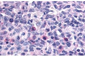 Anti-CXCR1 antibody  ABIN1048469 IHC staining of human lymph node. (CXCR1 anticorps  (N-Term))