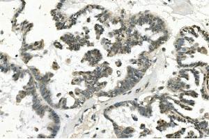 IHC analysis of PHEX using anti-PHEX antibody (ABIN7600072). (PHEX anticorps  (AA 145-718))