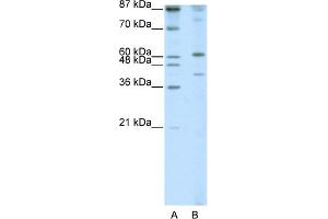 WB Suggested Anti-REXO4 Antibody Titration:  1. (REXO4 anticorps  (N-Term))