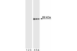 Western blot analysis of PARP (cleavage site-specific). (PARP1 anticorps  (Asp214, cleaved))