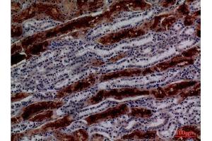 Immunohistochemistry (IHC) analysis of paraffin-embedded Human Kidney, antibody was diluted at 1:100. (GGT1 anticorps  (N-Term))