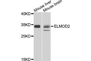 Western blot analysis of extracts of mouse liver and moues brain using ELMOD2 antibody. (ELMOD2 anticorps)