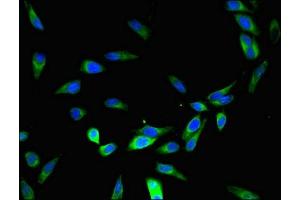 Immunofluorescent analysis of Hela cells using ABIN7150853 at dilution of 1:100 and Alexa Fluor 488-congugated AffiniPure Goat Anti-Rabbit IgG(H+L) (Dynein Assembly Factor 4, Axonemal (DNAAF4) (AA 109-295) anticorps)
