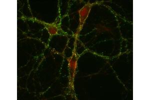 Immunocytochemistry (ICC) image for anti-GABA Transporter 1 (GAT1) (AA 585-599) antibody (ABIN1742535)