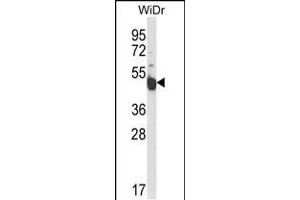 Western blot analysis of INSC Antibody in WiDr cell line lysates (35ug/lane) (INSC anticorps  (AA 410-437))