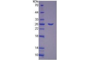 SDS-PAGE analysis of Mouse PYGM Protein. (PYGM Protéine)
