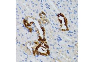 Immunohistochemistry of paraffin-embedded mouse kidney using GRB2 antibody.
