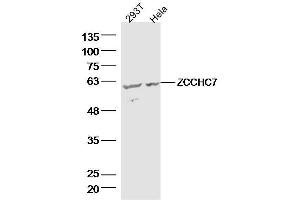 Lane 1: 293T lysates Lane 2: hela lysates probed with ZCCHC7 Polyclonal Antibody, Unconjugated  at 1:300 dilution and 4˚C overnight incubation. (ZCCHC7 anticorps  (AA 401-500))