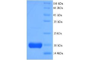 SDS-PAGE (SDS) image for Interleukin 2 (IL2) (AA 21-153) protein (His tag) (ABIN5713556)