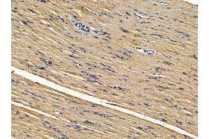 ABIN7095504 and ABIN7099561 at 1/100 staining rat muscle tissue by IHC-P. (VMP1 anticorps)