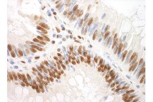 Immunohistochemistry (IHC) image for anti-Splicing Factor 3a, Subunit 3, 60kDa (SF3A3) (AA 451-501) antibody (ABIN7453782)
