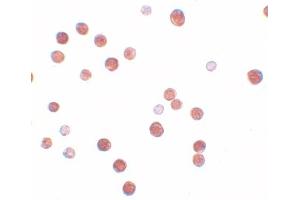 Immunohistochemistry (IHC) image for anti-Placenta-Specific 4 (PLAC4) (Middle Region) antibody (ABIN1031043)