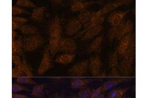 Immunofluorescence analysis of C6 cells using TXNRD1 Polyclonal Antibody at dilution of 1:100. (TXNRD1 anticorps)