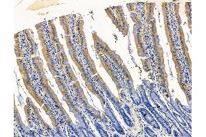 ABIN7096364 and ABIN7100427 at 1/100 staining rat colorectal tissue by IHC-P. (LMAN2 anticorps)