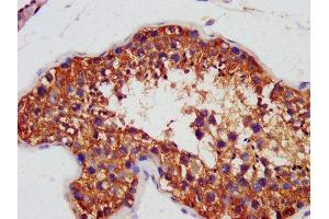 IHC image of ABIN7144472 diluted at 1:1400 and staining in paraffin-embedded human testis tissue performed on a Leica BondTM system.