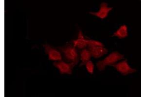 ABIN6274421 staining LOVO by IF/ICC.