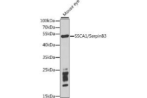 Western blot analysis of extracts of mouse eye, using SSC/SerpinB3 antibody (ABIN6131348, ABIN6147587, ABIN6147588 and ABIN6221070) at 1:1000 dilution. (SERPINB3 anticorps  (AA 1-230))
