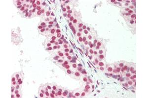 Human, Prostate: Formalin-Fixed Paraffin-Embedded (FFPE). (CTBP1 anticorps  (C-Term))