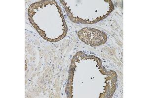 Immunohistochemistry of paraffin-embedded human prostate using CASP12 antibody. (Caspase 12 anticorps)