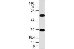 Image no. 1 for anti-Microphthalmia-Associated Transcription Factor (MITF) (AA 150-427) antibody (ABIN5027358) (MITF anticorps  (AA 150-427))
