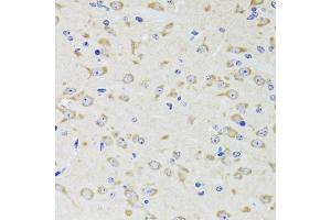 Immunohistochemistry of paraffin-embedded rat brain using YWHAZ antibody (ABIN5975846) at dilution of 1/100 (40x lens). (14-3-3 zeta anticorps)