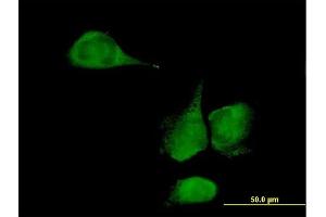 Immunofluorescence of purified MaxPab antibody to KLHDC4 on HeLa cell. (KLHDC4 anticorps  (AA 1-520))