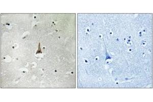 Immunohistochemistry (IHC) image for anti-Low Density Lipoprotein Receptor Related Protein 10 (LRP10) (AA 204-253) antibody (ABIN2890399)