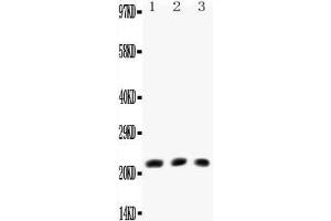 Anti-TNF beta antibody, All Western blottingAll lanes: Anti-TNF beta at 0. (LTA anticorps  (N-Term))
