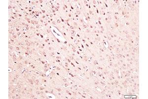Paraformaldehyde-fixed, paraffin embedded mouse brain tissue, Antigen retrieval by boiling in sodium citrate buffer(pH6) for 15min, Block endogenous peroxidase by 3% hydrogen peroxide for 30 minutes, Blocking buffer (normal goat serum) at 37°C for 20min, Antibody incubation with Rabbit Anti-NGF Polyclonal Antibody, Unconjugated  at 1:300 overnight at 4°C, followed by a conjugated secondary and DAB staining