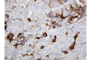 Image no. 1 for anti-ATP-Binding Cassette, Sub-Family B (MDR/TAP), Member 1 (ABCB1) (AA 995-1280) antibody (ABIN1491725)