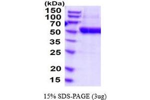 SDS-PAGE (SDS) image for Ectonucleoside Triphosphate diphosphohydrolase 3 (ENTPD3) (AA 44-485) protein (His tag) (ABIN6387811)