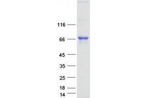 Validation with Western Blot