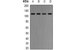 Western blot analysis of HMGCR expression in HepG2 (A), Hela (B), mouse spleen (C), rat liver (D) whole cell lysates. (HMGCR anticorps)