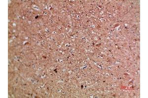Immunohistochemical analysis of paraffin-embedded human-brain, antibody was diluted at 1:200