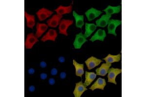 PGP9. (UCHL1 anticorps  (C-Term))
