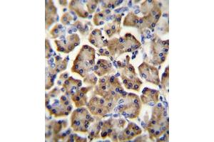 Immunohistochemistry (IHC) image for anti-Betacellulin (BTC) antibody (ABIN2996306) (Betacellulin anticorps)