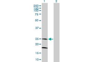 Western Blot analysis of KCNMB4 expression in transfected 293T cell line by KCNMB4 MaxPab polyclonal antibody. (KCNMB4 anticorps  (AA 1-210))