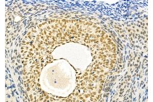 ABIN6257410 and ABIN6273736 at 1/100 staining Rat ovarian tissue by IHC-P.