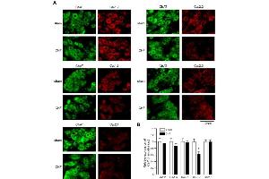Expression of CaV α subunits in rat ICG.