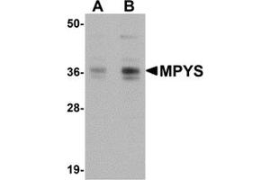 Western Blotting (WB) image for anti-Transmembrane Protein 173 (TMEM173) (C-Term) antibody (ABIN1030523) (STING/TMEM173 anticorps  (C-Term))