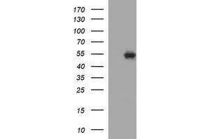 Image no. 1 for anti-Tubulin, beta 1 (TUBB1) antibody (ABIN1501570) (TUBB1 anticorps)