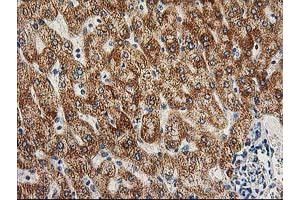 Image no. 11 for anti-Adenylate Kinase 4 (AK4) antibody (ABIN1496525)