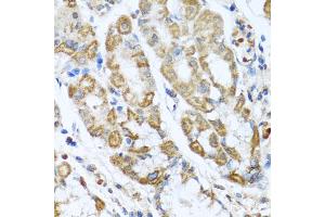 Immunohistochemistry of paraffin-embedded human stomach using ANTXR2 antibody (ABIN5975032) at dilution of 1/100 (40x lens). (ANTXR2 anticorps)