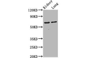 Western Blot Positive WB detected in: Rat kidney tissue, Mouse lung tissue All lanes: SRRM4 antibody at 4. (SRRM4 anticorps  (AA 400-479))