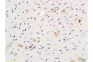 Formalin-fixed and paraffin embedded rat brain tissue labeled with Anti-Tsg101 Polyclonal Antibody , Unconjugated at 1:200 followed by conjugation to the secondary antibody, (SP-0023), and DAB staining