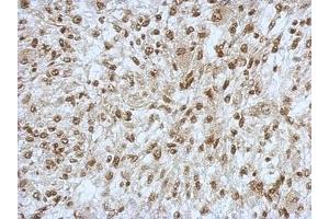 Image no. 2 for anti-Sin3A-Associated Protein, 130kDa (SAP130) (N-Term) antibody (ABIN1494118)