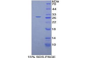SDS-PAGE analysis of Human GSTm4 Protein. (GSTM4 Protéine)