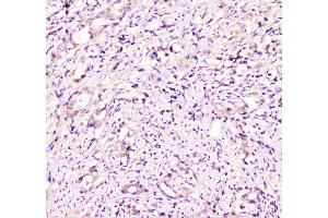 IHC analysis of TANK using anti-TANK antibody (ABIN6719508). (TANK anticorps)