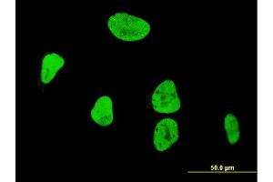 Immunofluorescence of monoclonal antibody to RUNX1 on HeLa cell.